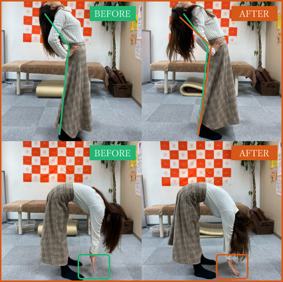 ビフォーアフター