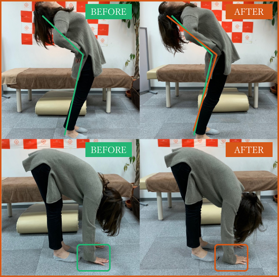 ビフォーアフター