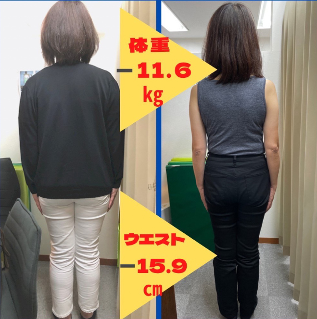 耳つぼダイエットができるサンライズ鍼灸整骨院へ